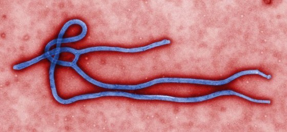 電子顯微鏡下的伊波拉病毒。