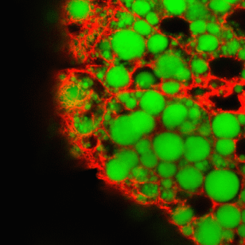 在螢光染色圖中的綠色部分就是細胞內的脂肪組織。