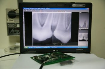透過直接讀取式數位X光感測器，牙齒樣本的X光影像能即時呈現在電腦螢幕上。