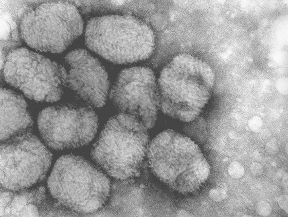 Smallpox_virus