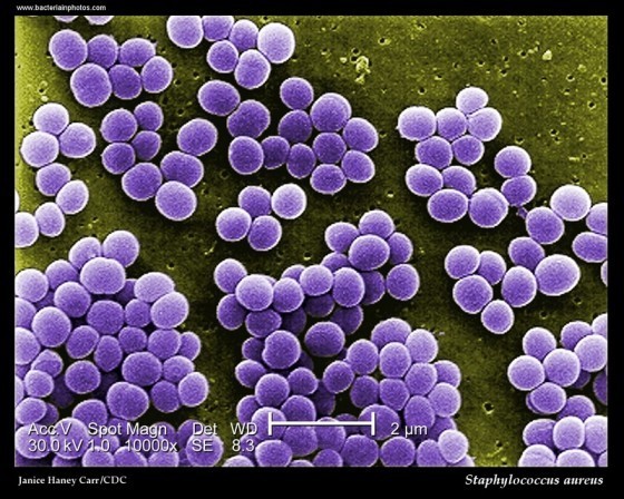 Staphylococcus aureus ETM
