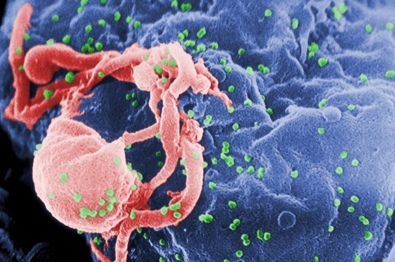 HIV-1病毒正從培養出來的淋巴球出芽，準備進一步散布開來。 source：wikimedia
