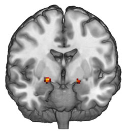 Huettel_fmri_small