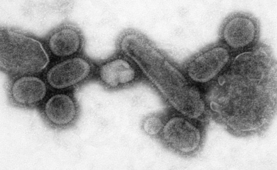 復原的西班牙流感病毒。圖／wikipedia