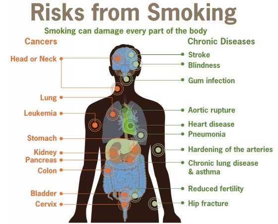 現代認為吸菸所造成的風險和危害。圖／wikipedia