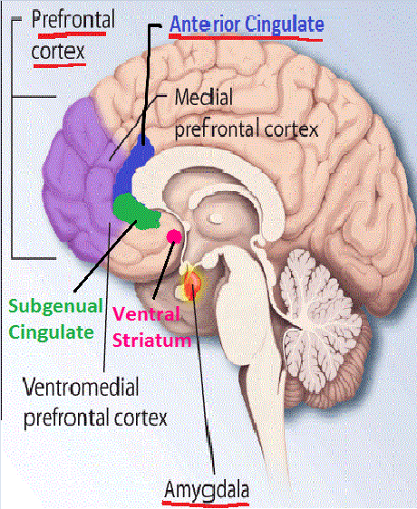Borderline_Personality_Disorder_(BPD)_Abnormal_Brain_Structures