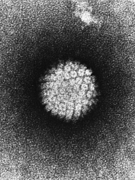 675px-Papilloma_Virus_(HPV)_EM