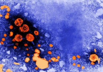 digitally-colorized-transmission-electron-micrograph-revealed-the-presence-of-hepatitis-b-virions-725x510