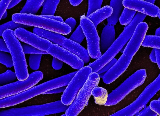 Photo by NIAID (CC BY 2.0). E. coli bacteria. https://goo.gl/hf9lcl