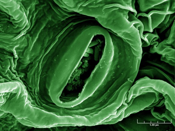 Photo by AgriLife Today (CC BY-NC-ND 2.0). E. coli bacteria on lettuce. https://goo.gl/jTrA8Q