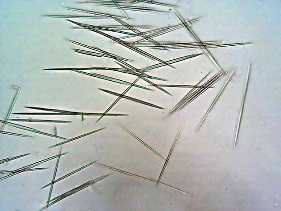 顯微鏡下看見的草酸鈣結晶。圖／Agong1 , CC0, https://commons.wikimedia.org/w/index.php?curid=10858734
