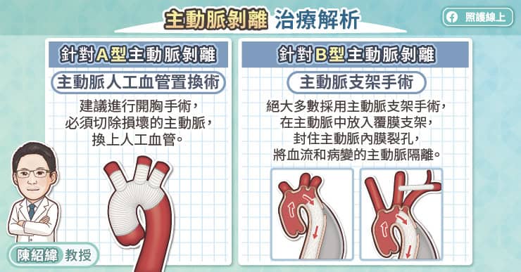 主動脈剝離治療