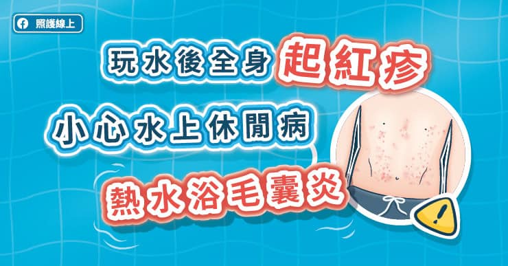 玩水後全身起紅疹,小心水上休閒病–熱水浴毛囊炎(圖文懶人包)