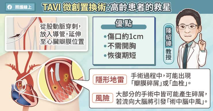 TAVI微創置換術