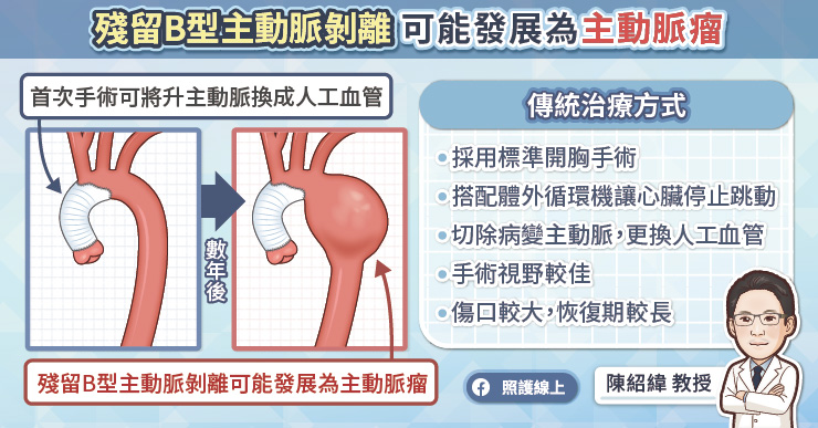 B 型主動脈剝離可能發展為主動脈瘤