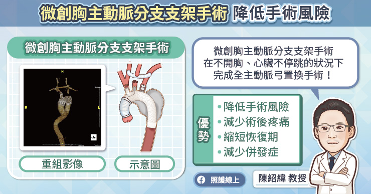 微創主動脈支架手術降低手術風險