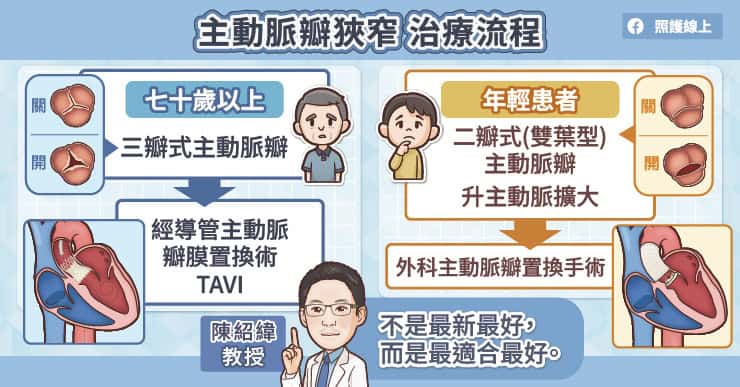 主動脈瓣狹窄治療流程