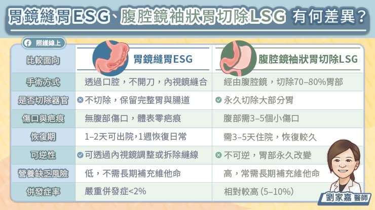 胃鏡縫胃ESG、腹腔鏡袖狀胃切除手術LSG有何差異?