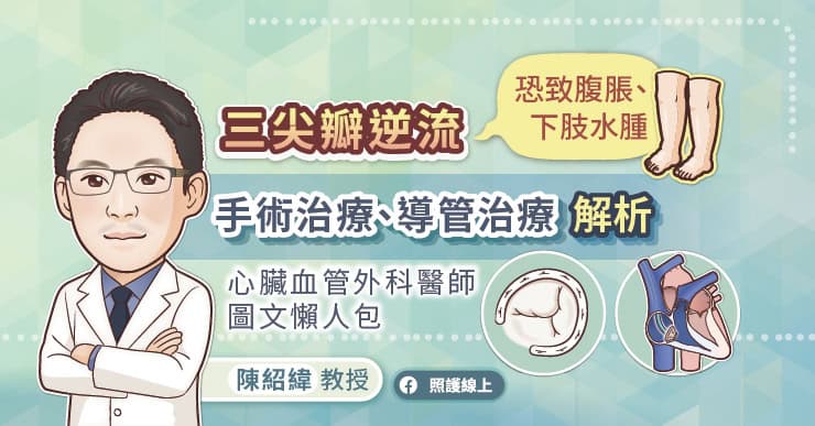 三尖瓣逆流恐致腹脹、下肢水腫,手術治療、導管治療解析,心臟血管外科醫師圖文懶人包