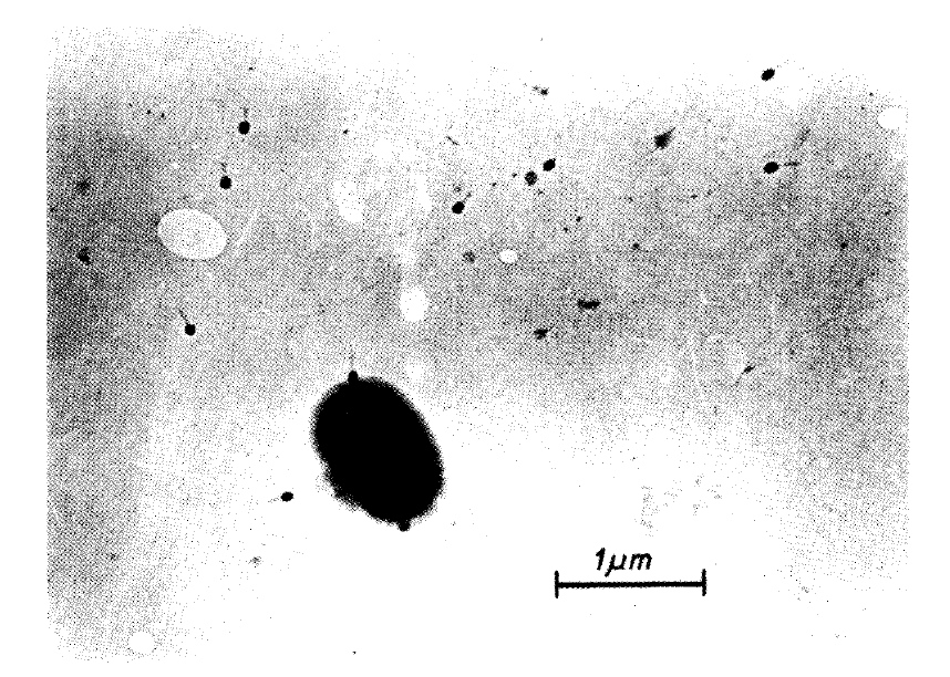 赫爾穆特使用電子顯微鏡拍攝的嗜菌體