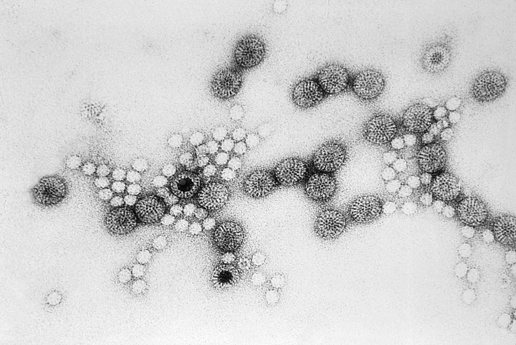 電子顯微鏡下的病毒顆粒