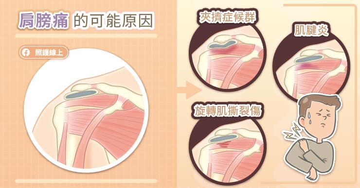 肩膀痛的可能原因