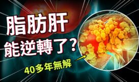 明明四肢纖細卻有脂肪肝？從「蟒蛇代謝」到次世代瘦瘦筆，破解大腦與內臟的肥胖密碼