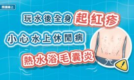 玩水後全身起紅疹，小心水上休閒病–熱水浴毛囊炎（圖文懶人包）